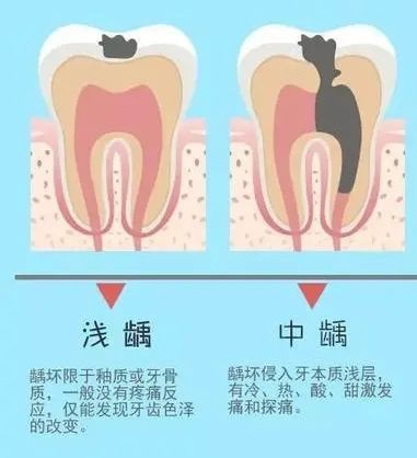 画拉链图片_画拉链用什么胶水粘_拉链怎么画