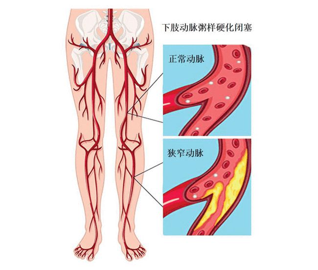 腿音_腿音未来的图片_腿音表情包