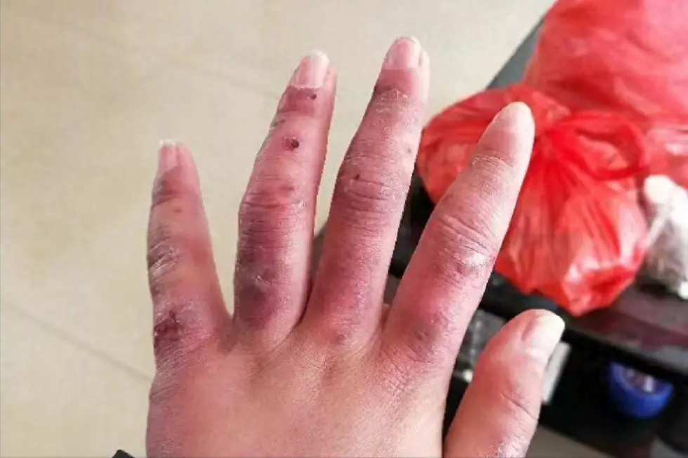 手机换屏后玩游戏滑轮乱跳_手机换了屏玩游戏乱动_玩游戏手机屏幕乱动